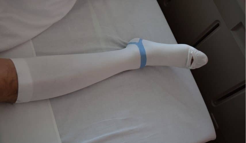 Meia antitrombo usada por paciente