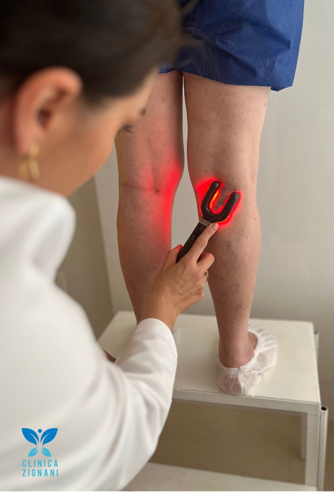 Diagnóstico e marcação de veias varicosas