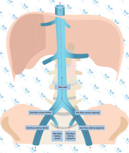 Esquema representando as veias ilíacas