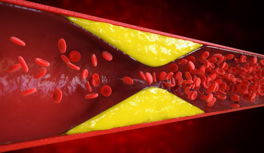 Veias das pernas entupidas