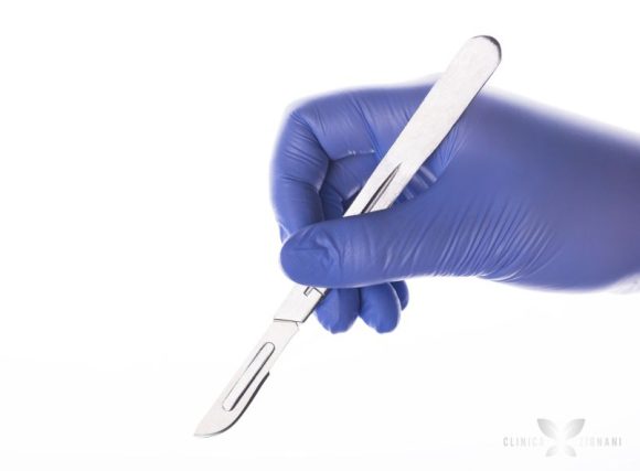Bisturi em uma cirurgia
