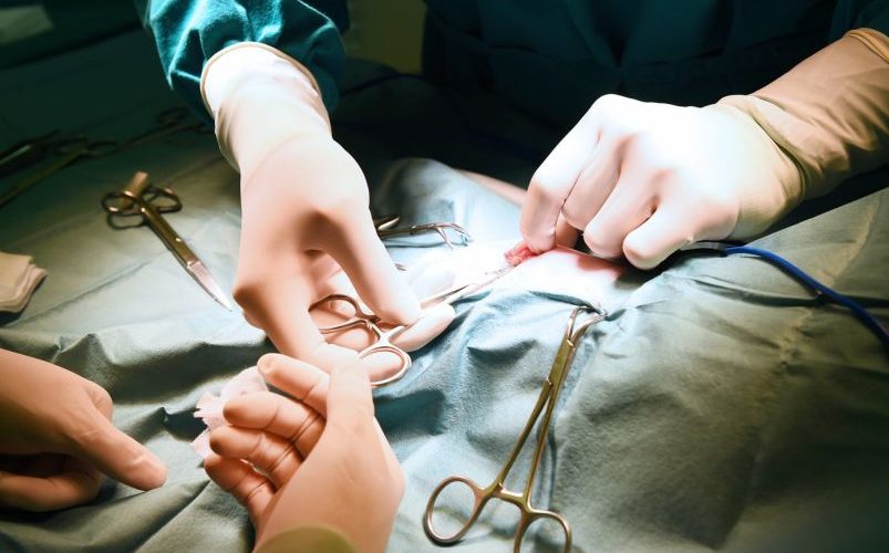 Procedimento de cirurgia de varizes em curso